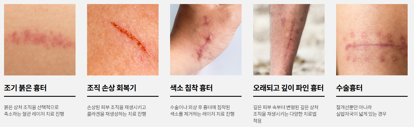 설명