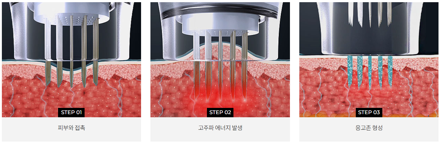 설명
